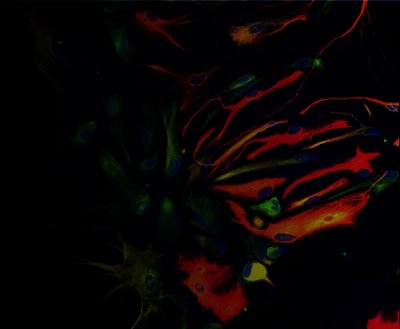 DiversImmune platform and MultiMab Platform